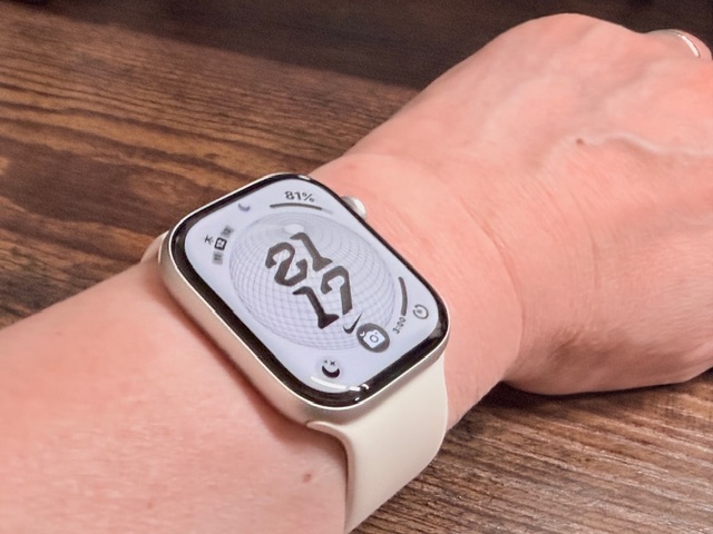 Apple Watch Series 11 装着写真